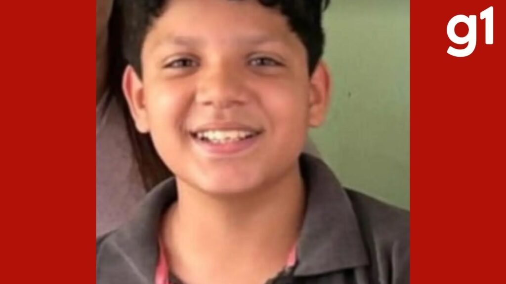 Adolescente morre após dois meses de internação por queimaduras em Rondonópolis