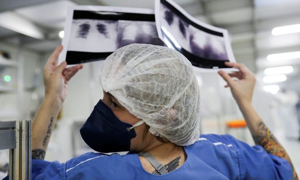 Falta de rastreamento no SUS faz 90% dos casos de câncer de pulmão chegarem tarde ao tratamento