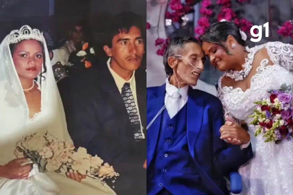 Casal realiza sonho de união civil após vinte e oito anos juntos em hospital