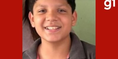 Adolescente morre após dois meses de internação por queimaduras em Rondonópolis