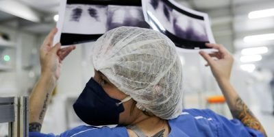 Falta de rastreamento no SUS faz 90% dos casos de câncer de pulmão chegarem tarde ao tratamento