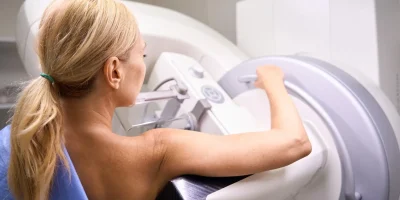 Medicina de precisão revoluciona o tratamento do câncer de mama no Brasil